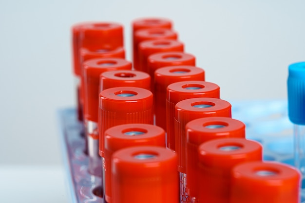 Tubos de amostra de sangue equipamentos médicos close-up