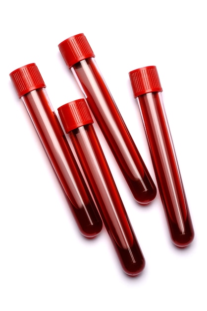Foto tubos de ensaio com plugue vermelho isolado no branco