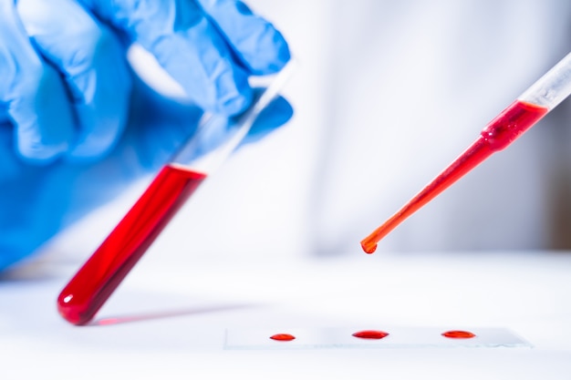 Tubos de ensaio com sangue em laboratório