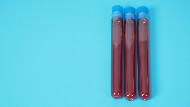 Tubos de ensaio de sangue isolados sobre fundo azul.