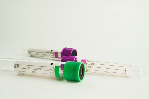 tubos de vácuo para coleta e amostras de sangue em foco seletivo de fundo branco