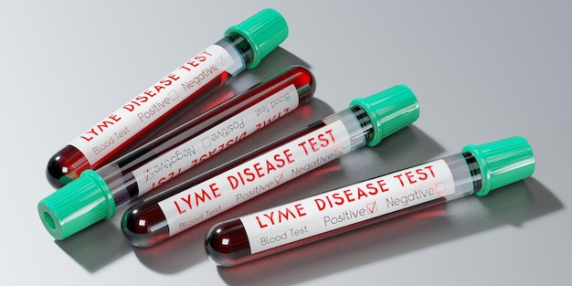 Tubos de ensayo del virus de la enfermedad de Lyme análisis de sangre ilustración 3D