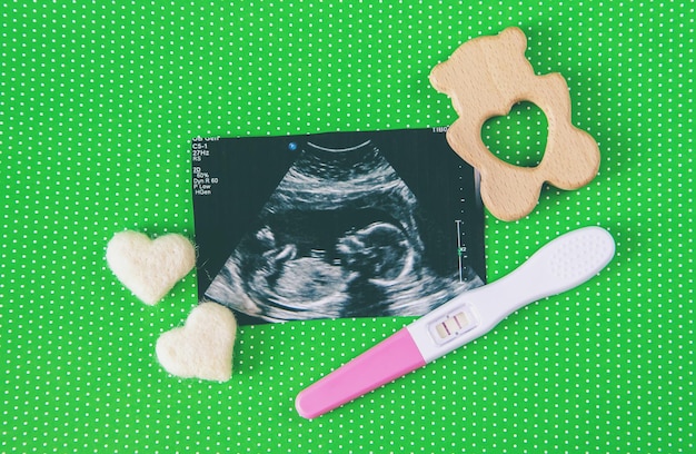 Ultraschallbild eines Babyfotos. Selektiver Fokus. Natur.