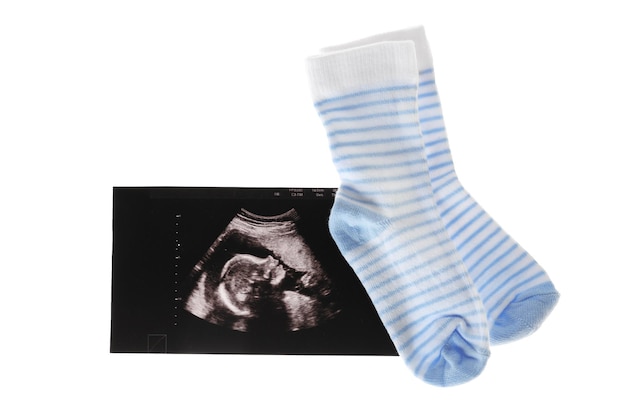 Ultraschallbild von Baby- und Kindersocken auf weißem Hintergrund