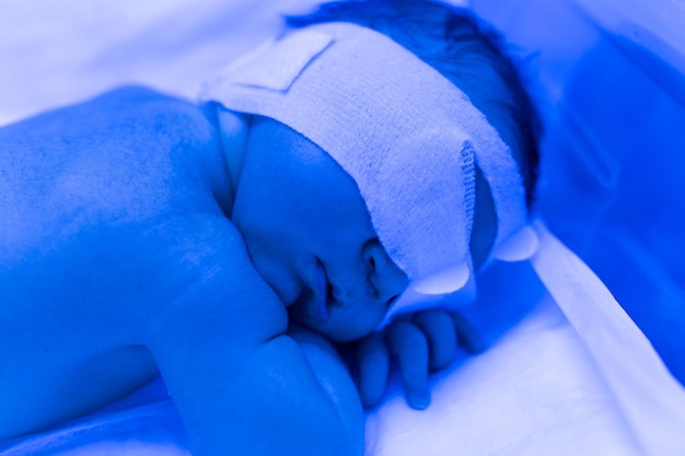 Foto um bebê recém-nascido encontra-se sob lâmpadas ultravioleta sob luz azul tratamento de alta bilirrubina da incubadora ultravioleta de icterícia infantil
