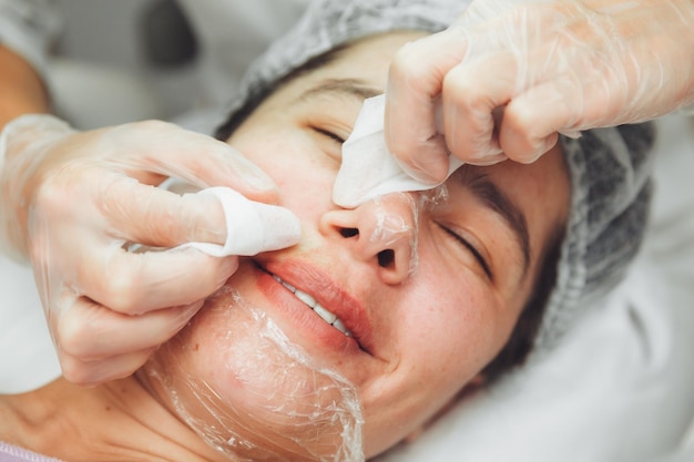 Um cosmetologista em um salão de beleza faz uma limpeza mecânica do rosto de uma mulher com as próprias mãos remoção de acne rosto fortemente poluído