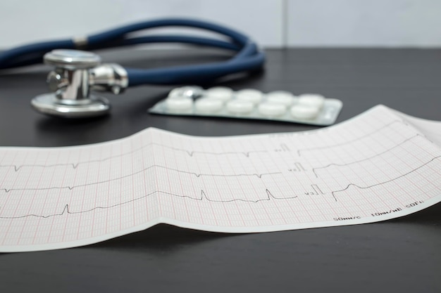 Um eletrocardiograma, um estetoscópio azul e pílulas estão sobre uma mesa escura em um consultório médico