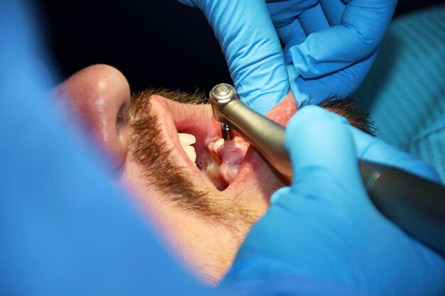 Foto um homem com uma barba ligeira submetendo-se a um procedimento dentário