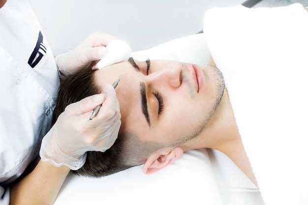 Um homem encontra-se no procedimento de limpeza da pele de manchas e cravos pretos.