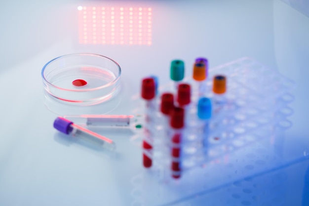 Um médico assistente de laboratório profissional médico realiza uma análise em um laboratório usa tubos de ensaio uma pipeta e uma placa de Petri para a presença de bactérias no corpo humano Foco seletivo