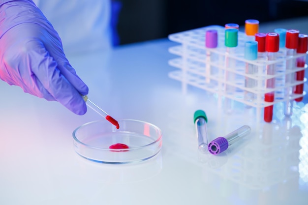 Um médico assistente de laboratório profissional médico realiza uma análise em um laboratório usa tubos de ensaio uma pipeta e uma placa de Petri para a presença de bactérias no corpo humano Foco seletivo
