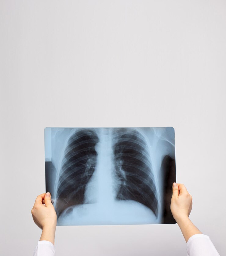 Foto um médico examina um raio-x dos pulmões de um paciente com pneumonia