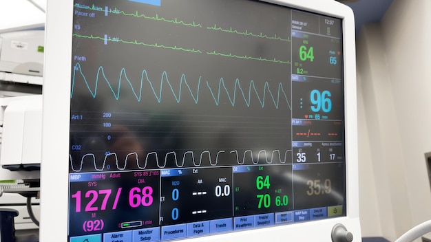 Um monitor com um gráfico de frequência cardíaca