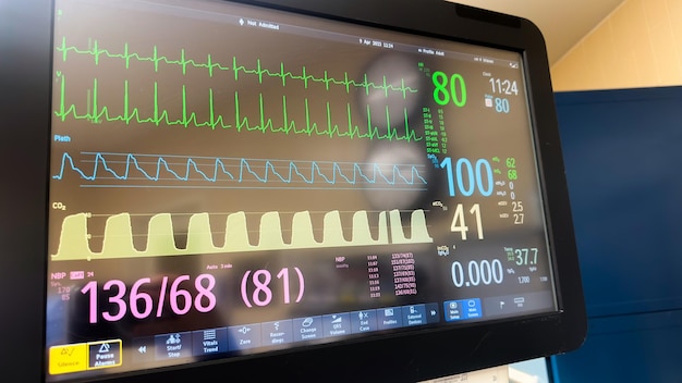 Foto um monitor com um monitor de frequência cardíaca