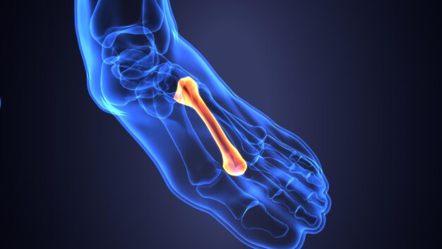 Foto um pé com uma lesão no joelho que mostra uma perna inferior e a perna inferior