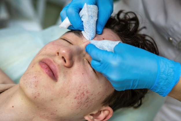 Um procedimento de limpeza manual ou mecânica do rosto por uma esteticista. Peeling profissional de pele