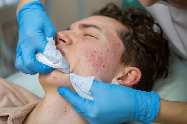 Um procedimento de limpeza manual ou mecânica do rosto por uma esteticista. Peeling profissional de pele