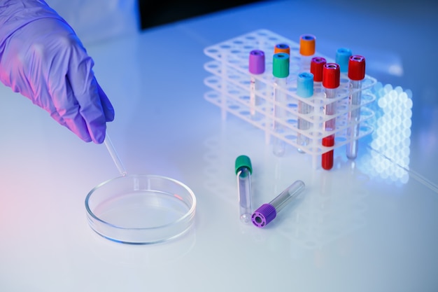 Um profissional médico, assistente de laboratório, médico realiza uma análise em laboratório, usa tubos de ensaio, uma pipeta e uma placa de Petri para a presença de bactérias no corpo humano