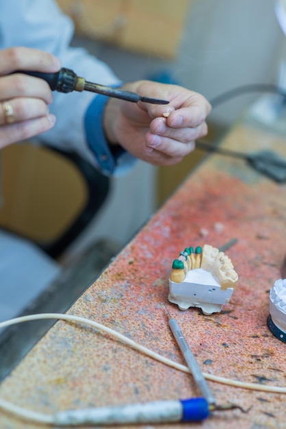 Um técnico dentário faz dentaduras parciais A produção de dentes falsos ou pontes dentárias Closeup