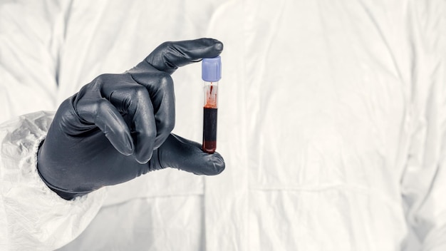 Um tubo de ensaio na mão de um homem fecha um homem com uma máscara médica segurando uma garrafa de líquido vermelho Conceito de amostras de sangue pesquisa médica e química