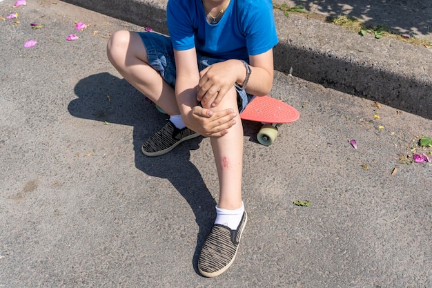 Foto uma abrasão na perna de uma criança por ter caído em um caminho de asfalto enquanto andava de skate o menino caiu enquanto andava de skate esportes extremos