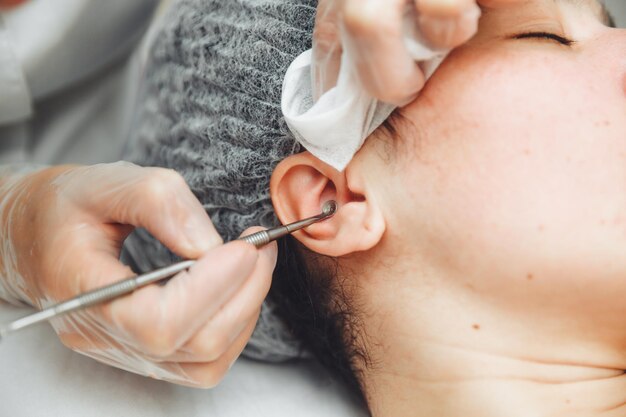 Uma jovem está deitada em um sofá durante procedimentos cosméticos sobre os quais um cosmetologista espreme depósitos de gordura e espinhas com uma limpeza especial de ferramentas de metal