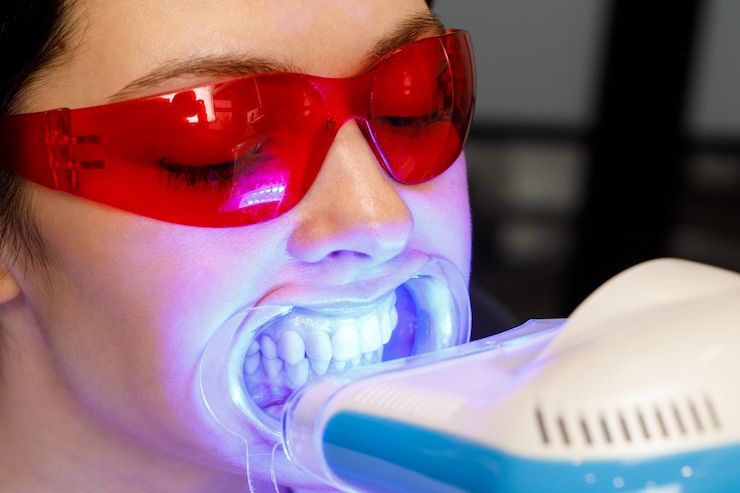 Foto uma jovem recebe um procedimento de branqueamento dos dentes em uma clínica dentária
