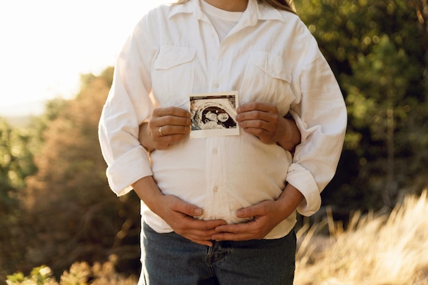 uma mulher grávida e um jovem marido estão se abraçando enquanto seguram uma varredura de ultrassom perto da grávida