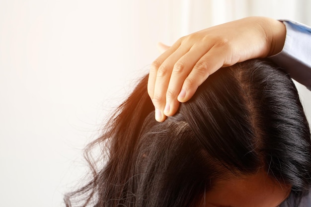 Uma mulher tem problemas com cabelo e couro cabeludo, ela tem caspa devido a reações alérgicas a xampus. e condicionador de cabelo