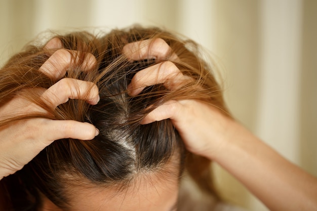 Uma mulher tem problemas com cabelo e couro cabeludo