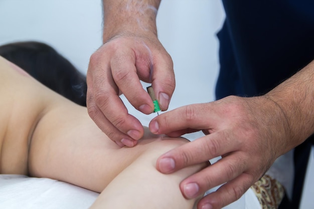 Uma mulher tomando um tratamento de medicina alternativa, procedimento de moxoterapia, mãos, medicina chinesa