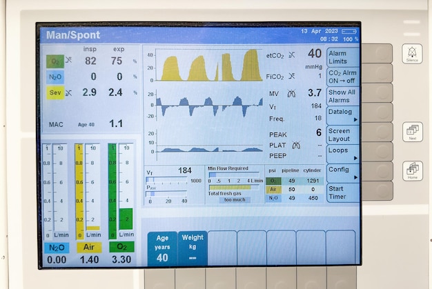 Uma tela com um gráfico que diz airsacc.