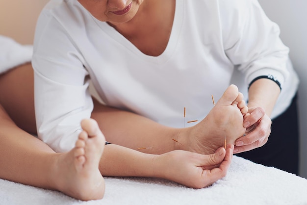 Foto uma terapia de agulha de acupuntura no estúdio