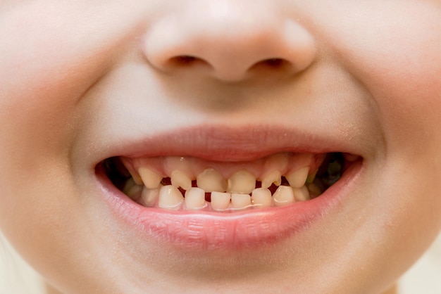 Uma visão aproximada dos dentes de leite infantis