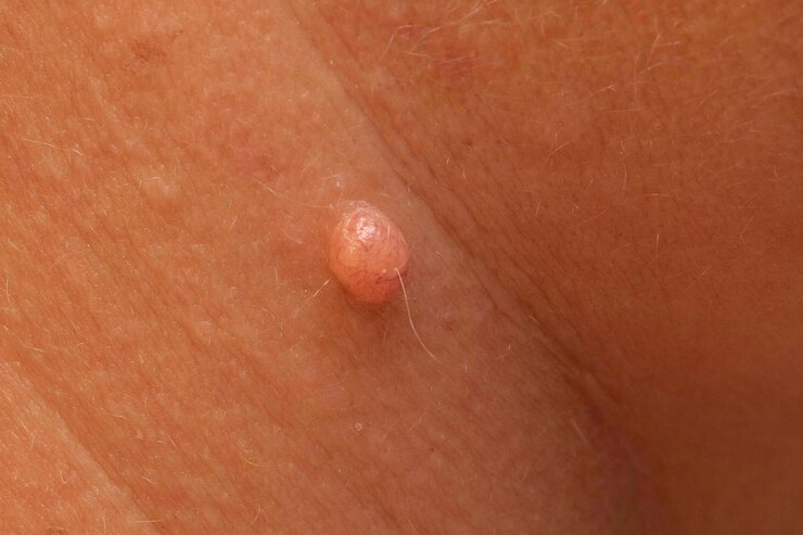 Foto uma visão macro de pêlos provenientes de uma etiqueta de pele em um corpo humano visão detalhada da pele
