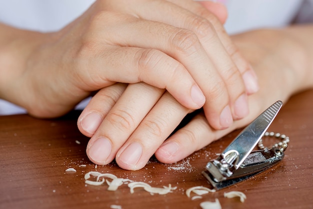 Uñas de una mujer que corta las uñas demasiado cortas con un cortaúñas. El concepto de cuidado, uñas limpias.