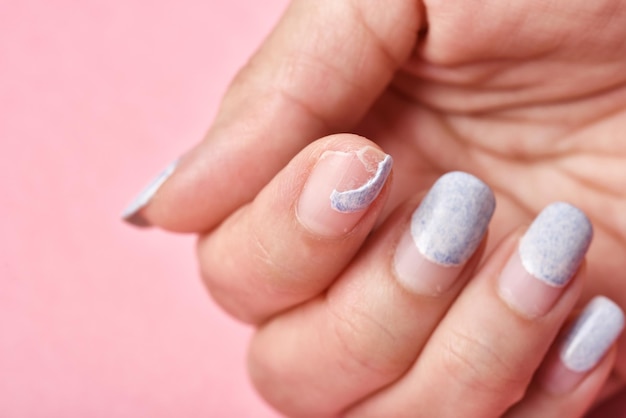 Uñas rotas rotas, daños por debilidad de las uñas debido al revestimiento de esmalte de gel, higiene de la manicura de las uñas.