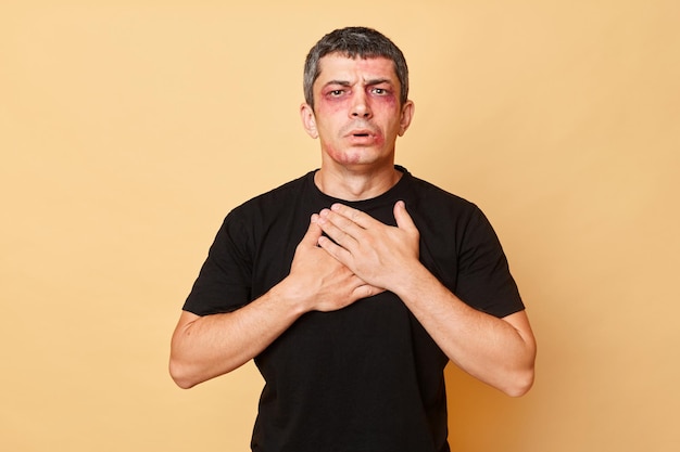 Foto ungesund traumatisierter mann im schwarzen t-shirt mit blauen flecken und schürfwunden im gesicht, isoliert vor beigem hintergrund, sieht unglücklich aus und hat nach einem unfall schmerzen in der brust