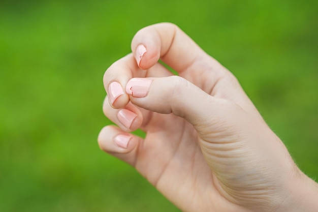 Unha quebrada na mão de uma mulher com manicure em um fundo verde