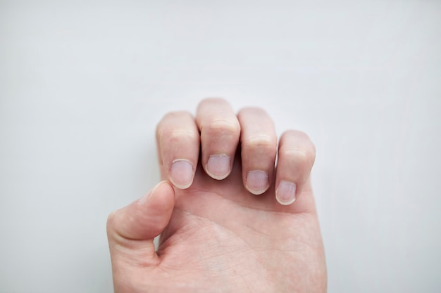 unhas masculinas compridas e desarrumadas em um fundo claro, o braço dos homens precisa de cuidados com as unhas conceito de manicure masculina