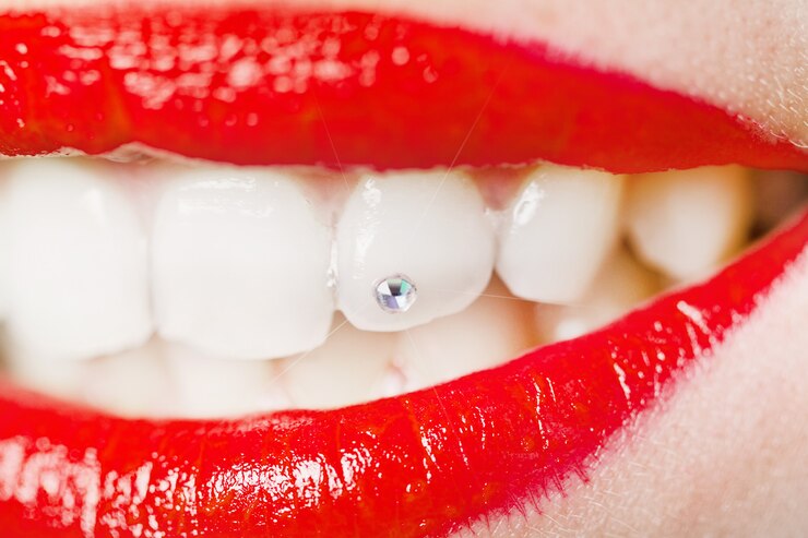 Uniendo los dientes