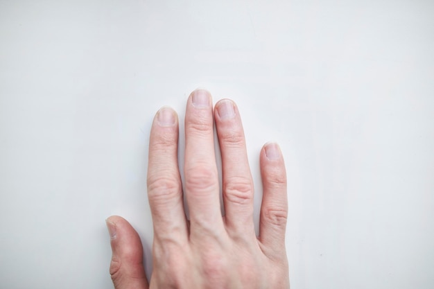 Unordentliche lange männliche Nägel auf hellem Hintergrund Männerarm brauchen Nagelpflege männliches Manikürekonzept