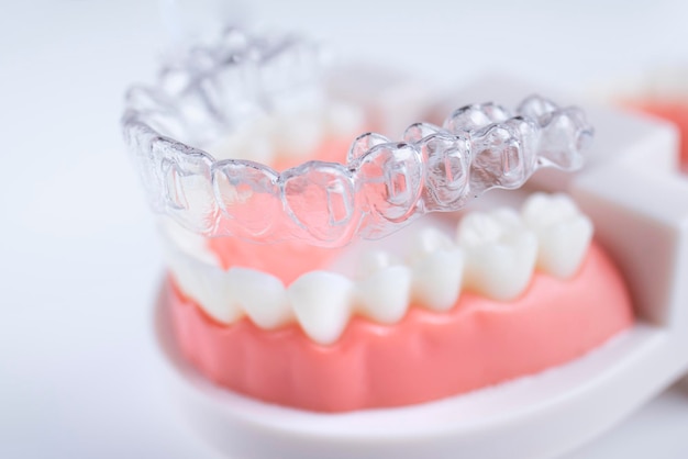 Unsichtbare und abnehmbare Aligners für die Zahnvergleichung