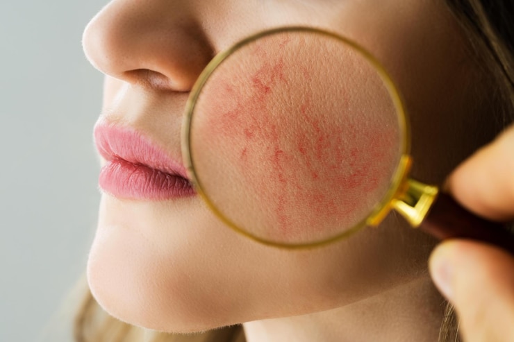 Foto untersuchung der gesichtshaut bei rosacea-problemen