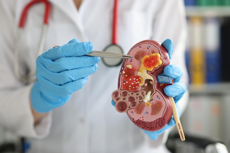 Foto urologia e tratamento de doenças renais de perto