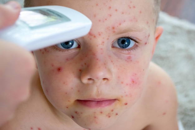 Vacinação natural doença contagiosa