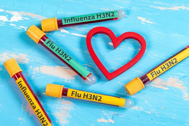 Vakuumröhrchen zur Blutentnahme geschrieben FLU H3N2 in Bezug auf den Grippetyp