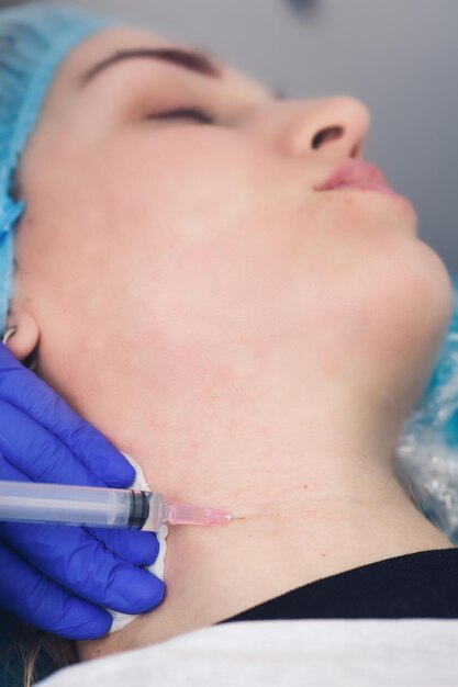 Verjüngung der weiblichen Halshaut mit Mesotherapie-Injektionen in einer Kosmetikklinik Halshautkonturierung Mesotherapie und Biorevitalisierung