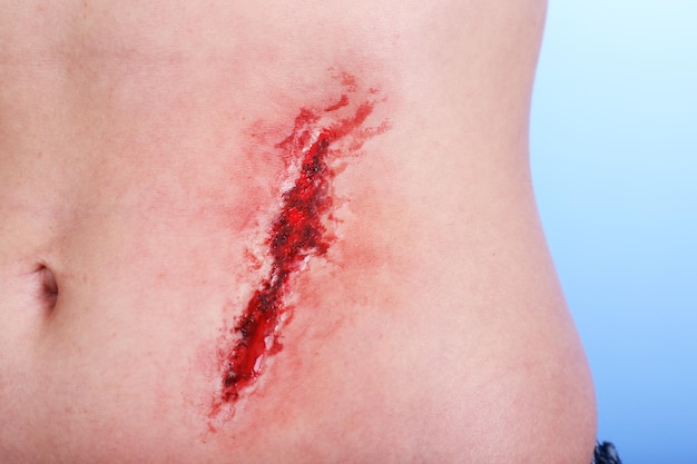 Verletzter Bauch mit Blut auf blauem Hintergrund