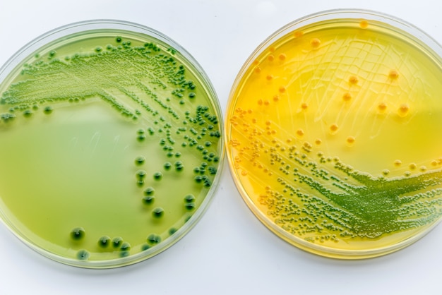 Vibrio parahaemolyticus y Vibrio cholera